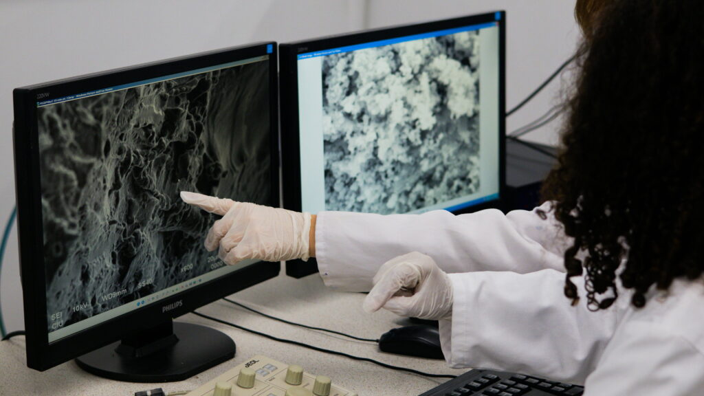 AI for Critical Stroke Diagnosis