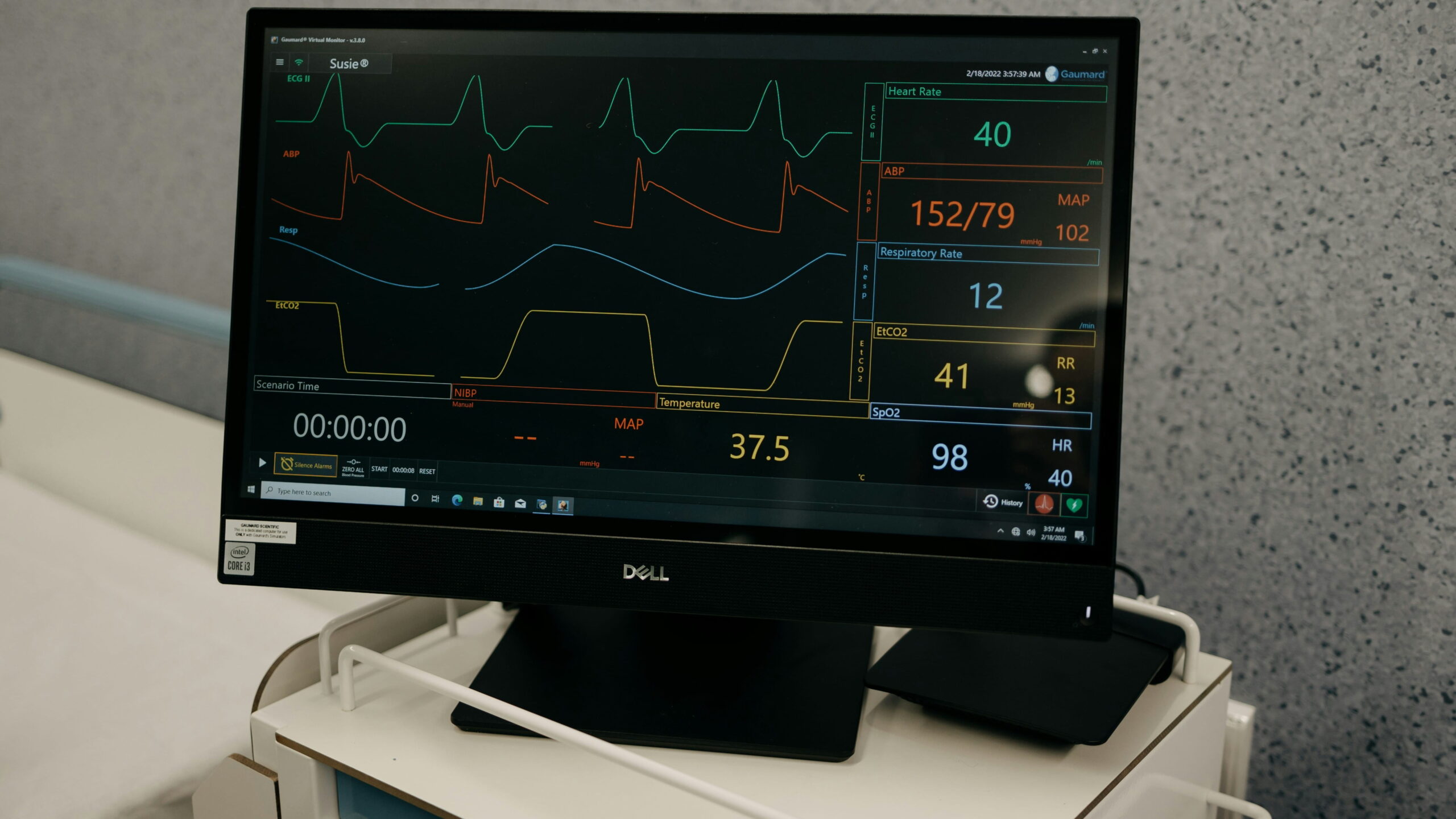 AI Powered Haemodialysis Machines