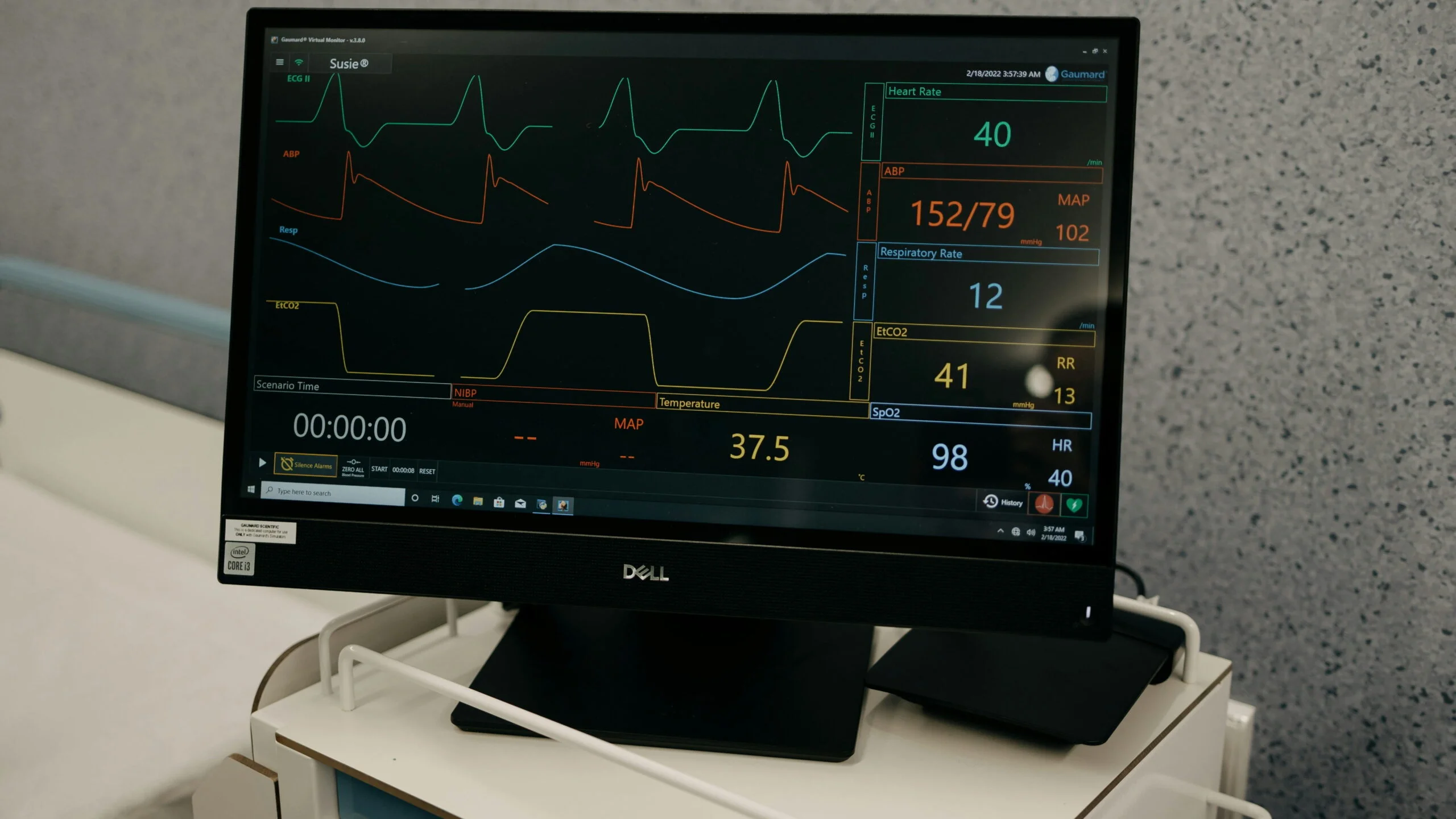 AI Powered Haemodialysis Machines